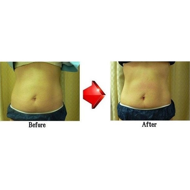 脂肪燃焼クリーム　テクニカルプロTechnical PRO　130ml TechnicalPRO（テクニカルプロ） | Cyberbeauty®株式会社 最新鋭